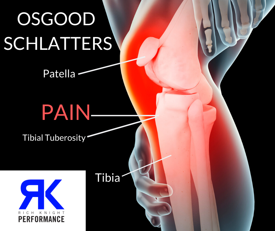 Osgood Schlatters Disease/ Knee Injury Know the facts Team Grassroots